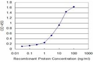 Detection limit for recombinant GST tagged LAD1 is approximately 0. (Ladinin 1 抗体  (AA 418-517))