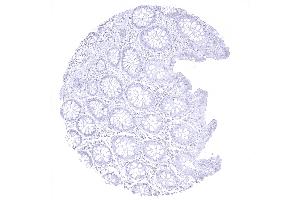 colon descendens mucosa (Recombinant MBP 抗体  (AA 150-250))