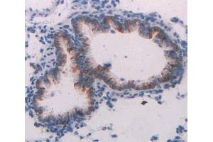 IHC-P analysis of lung tissue, with DAB staining. (Neuregulin 1 抗体  (AA 328-486))
