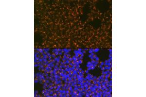 Immunofluorescence analysis of Jurkat cells using CCR8 Rabbit mAb (ABIN1683150, ABIN3018779, ABIN3018780 and ABIN7101661) at dilution of 1:100 (40x lens). (CCR8 抗体)
