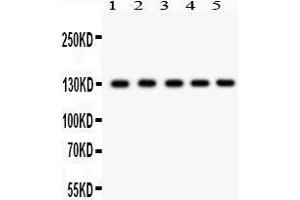 Western Blotting (WB) image for anti-Death-Domain Associated Protein (DAXX) (AA 56-345) antibody (ABIN3043822) (DAXX 抗体  (AA 56-345))
