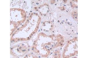 Used in DAB staining on fromalin fixed paraffin- embedded Kidney tissue (PTBP1 抗体  (AA 1-531))