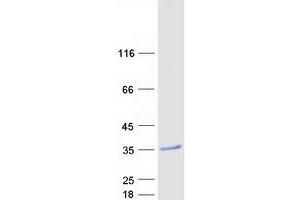 Western Blotting (WB) image for Myelin Basic Protein (MBP) (Transcript Variant 8) protein (Myc-DYKDDDDK Tag) (ABIN2726639)