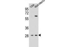 Western blot analysis in CEM,MDA-MB453 cell line lysates (35ug/lane) using Interleukin-12 beta/IL12B  Antibody (C-term). (IL12B 抗体  (C-Term))
