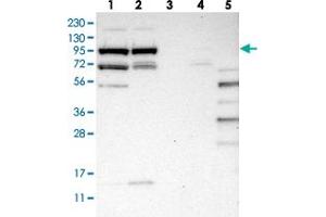 Western blot analysis of Lane 1: RT-4, Lane 2: U-251 MG, Lane 3: Human Plasma, Lane 4: Liver, Lane 5: Tonsil with SLFN5 polyclonal antibody  at 1:250-1:500 dilution. (SLFN5 抗体)