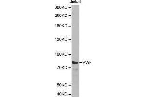 Western blot analysis of extracts of Jurkat cell line, using VWF antibody. (VWF 抗体  (AA 50-150))