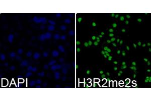 Immunofluorescence analysis of 293T cells using Symmetric DiMethyl-Histone H3-R2 antibody.