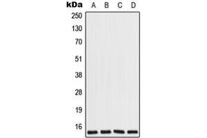 Western blot analysis of COX7A2L expression in Jurkat (A), HeLa (B), Raw264.