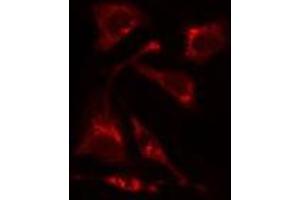 ABIN6275505 staining HuvEc cells by IF/ICC. (RIMKLA 抗体  (Internal Region))