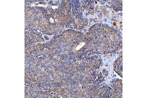 IHC analysis of TTC7B using anti-TTC7B antibody (ABIN7601050). (TTC7B 抗体  (AA 275-730))