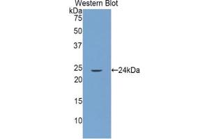 Western blot analysis of the recombinant protein. (GRIP1 抗体  (AA 79-268))