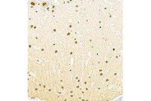Immunohistochemistry (Paraffin-embedded Sections) (IHC (p)) image for anti-Suppressor of Variegation 3-9 Homolog 1 (Drosophila) (SUV39H1) antibody (ABIN7075770)