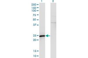 Western Blot analysis of SPA17 expression in transfected 293T cell line by SPA17 monoclonal antibody (M03), clone 3B6. (SPA17 抗体  (AA 51-149))