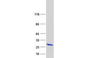 Validation with Western Blot