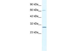WB Suggested Anti-PAntibody   Titration: 2. (PARP11 抗体  (N-Term))