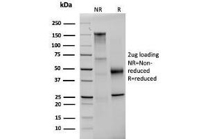 SDS-PAGE Analysis Purified Prolactin Mouse Monoclonal Antibody (PRL/2642). (Prolactin 抗体  (AA 63-201))