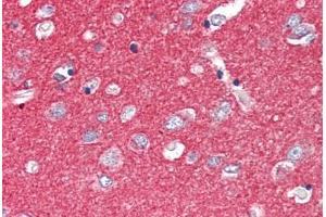 Human Brain, Cortex (formalin-fixed, paraffin-embedded) stained with SNAP25 antibody ABIN337119 at 2. (SNAP25 抗体  (AA 193-206))