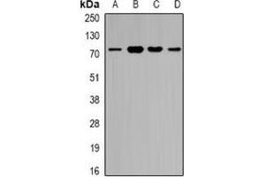 Western blot analysis of ZNF195 expression in SW620 (A), A549 (B), mouse heart (C), rat brain (D) whole cell lysates. (ZNF195 抗体)