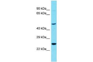 Host: Rabbit Target Name: RTN4RL1 Sample Type: OVCAR-3 Whole Cell lysates Antibody Dilution: 1. (RTN4RL1 抗体  (C-Term))