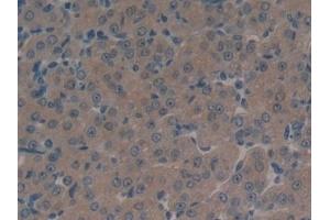 Immunohistochemistry (IHC) image for anti-ATP-Binding Cassette, Sub-Family C (CFTR/MRP), Member 1 (ABCC1) (AA 1219-1469) antibody (ABIN7440026)