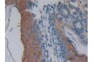 Immunohistochemistry (IHC) image for anti-Membrane Protein, Palmitoylated 2 (MAGUK P55 Subfamily Member 2) (MPP2) (AA 3-214) antibody (ABIN7442810)