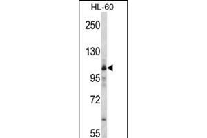 Western blot analysis of RS Antibody (C-term) (ABIN392313 and ABIN2841964) in HL-60 cell line lysates (35 μg/lane). (Mars (MARS) (AA 872-899), (C-Term) 抗体)