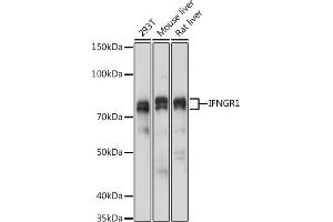 Western blot analysis of extracts of various cell lines, using IFNGR1 antibody (ABIN6127566, ABIN6142197, ABIN6142198 and ABIN6221420) at 1:1000 dilution. (IFNGR1 抗体  (AA 270-489))