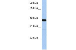 WB Suggested Anti-ZNF781 Antibody Titration:  0. (ZNF781 抗体  (N-Term))