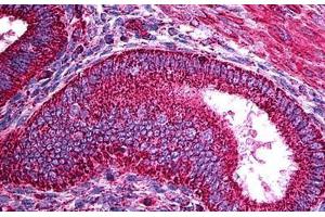 Human Uterus: Formalin-Fixed, Paraffin-Embedded (FFPE) (TRF1 抗体)
