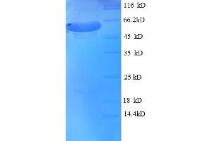 SDS-PAGE (SDS) image for tau Protein (AA 2-459) protein (His-SUMO Tag) (ABIN5709911)