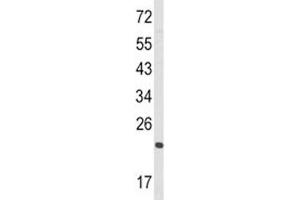 Western Blotting (WB) image for anti-RAN, Member RAS Oncogene Family (RAN) (AA 12-39) antibody (ABIN3032431)
