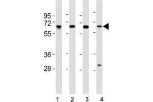 Western Blotting (WB) image for anti-Histone Deacetylase 1 (HDAC1) (AA 449-482) antibody (ABIN3031222)