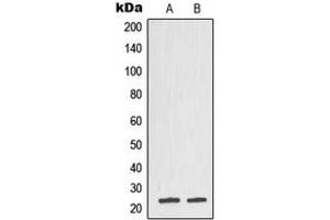 Western blot analysis of TCTP expression in DU145 (A), CCRFCEM (B) whole cell lysates. (TPT1 抗体  (Center))