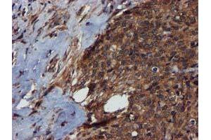 Immunohistochemistry (IHC) image for anti-Complement Component 1, S Subcomponent (C1S) antibody (ABIN1497565) (C1S 抗体)