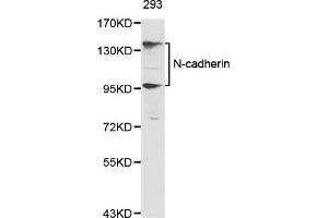 Western Blotting (WB) image for anti-Cadherin 2 (CDH2) (AA 450-550) antibody (ABIN5663657) (N-Cadherin 抗体  (AA 450-550))