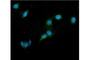 IF analysis of GRK2 using anti-GRK2 antibody (ABIN7602826).