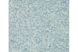 Immunohistochemistry (Paraffin-embedded Sections) (IHC (p)) image for anti-Scaffold Attachment Factor B (SAFB) antibody (ABIN7263975)