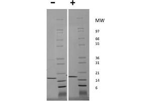 SDS-PAGE of Human Tumor Necrosis Factor alpha Recombinant Protein (Animal Free) SDS-PAGE of Human Tumor Necrosis Factor alpha Animal Free Recombinant Protein. (TNF alpha 蛋白)