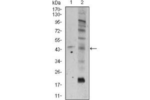Western blot analysis using FZD5 antibody against A549 (1), and PC-3 (2) cell lysate. (FZD5 抗体  (AA 151-217))