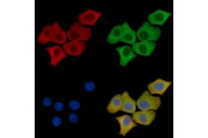 Cathepsin D Mouse Monoclonal Antibody staining HepG2 cells by IF/ICC.