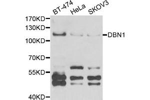 Western blot analysis of extracts of various cell lines, using DBN1 antibody (ABIN5973773) at 1/1000 dilution. (DBN1 抗体)