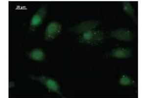 Immunostaining analysis in HeLa cells. (EIF4ENIF1 抗体)