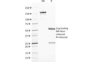 SDS-PAGE Analysis Purified ZAP70 Mouse Monoclonal Antibody (ZAP70/2046). (ZAP70 抗体  (AA 247-382))