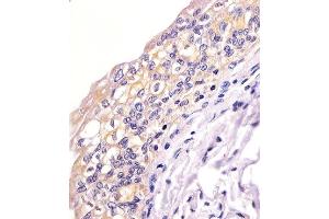 Paraformaldehyde-fixed, paraffin embedded human bladder tissue, Antigen retrieval by boiling in sodium citrate buffer (pH6. (BID 抗体)