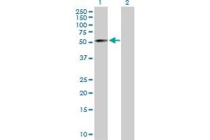 Western Blot analysis of ZNF136 expression in transfected 293T cell line by ZNF136 MaxPab polyclonal antibody. (ZNF136 抗体  (AA 1-540))