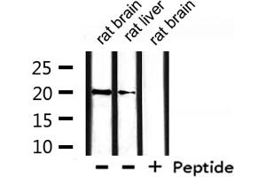 Western blot analysis of extracts from rat liver, rat brain, using hCG beta Antibody.