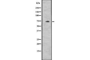 Western blot analysis of CYLC1 expression in Hela cell lysate,The lane on the left is treated with the antigen-specific peptide. (CYLC1 抗体)