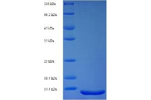 SDS-PAGE (SDS) image for SET Domain and Mariner Transposase Fusion Gene (SETMAR) (AA 1-118), (full length) protein (His tag) (ABIN5711303)