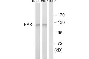 Western blot analysis of extracts from HUVEC cells and MCF-7 cells, using FAK (epitope around residue 843) antibody. (FAK 抗体)