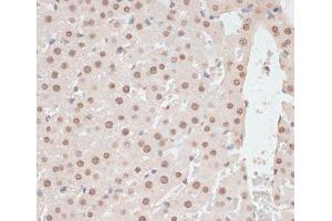Immunohistochemistry (Paraffin-embedded Sections) (IHC (p)) image for anti-Protein Kinase, AMP-Activated, alpha 1 Catalytic Subunit (PRKAA1) (pThr172), (pThr183) antibody (ABIN7265094)